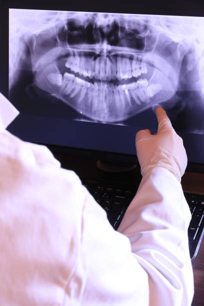 Best Knocked-Out Tooth (Avulsed Tooth) Treatment in Pelham, GA